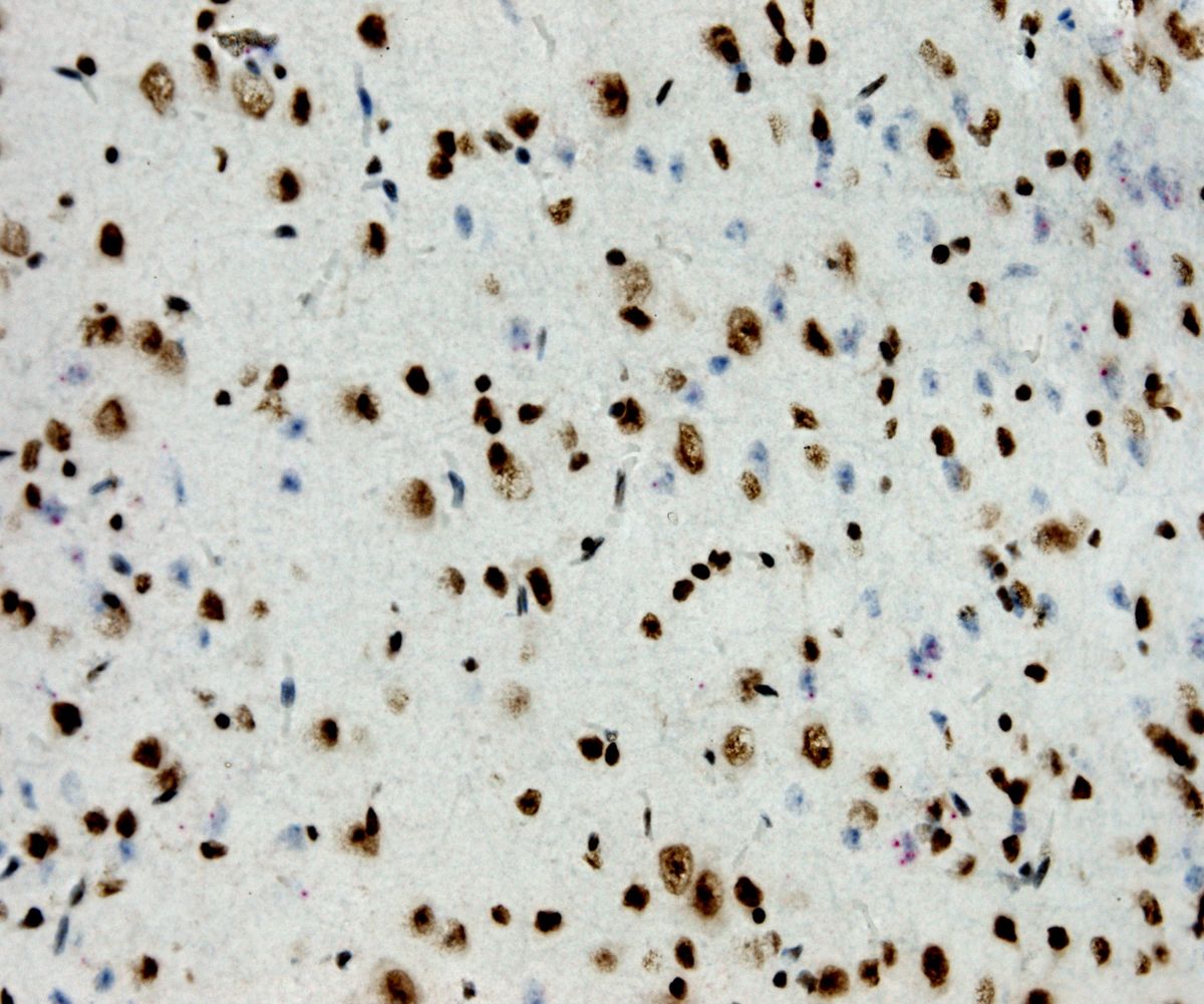 Brain tissue staining